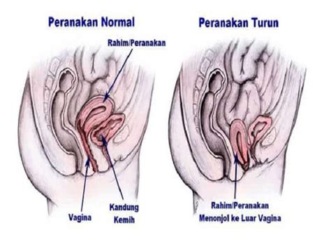 Aku udah punya seorang cewek.yah dia kan udah gede.tinggi banget anaknya alkisah, aku pacaran ama dia lama banget. Peranakan Jatuh - Ini Punca & Kesannya! - June 2020 ...