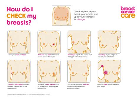 The following may be signs of male breast cancer: Breast Cancer Awareness Month: Know the Signs