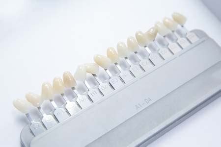 Learn if porcelain veneers will fix your crooked teeth. Find the Answer To: Can Veneers Fix Crooked Teeth?