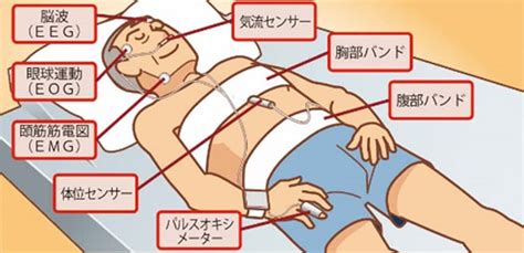 May 12, 2020 · 終夜睡眠ポリグラフ検査 睡眠時無呼吸症候群であるかどうかを調べる検査を、「睡眠ポリソムノグラフ検査（psg検査）」といいます。 睡眠時無呼吸症候群の検査は、夜、寝ている時に行わないといけません。かつては、検査の装置も大き. 精密検査が受けられる病院 - SAS-睡眠時無呼吸症候群のための ...