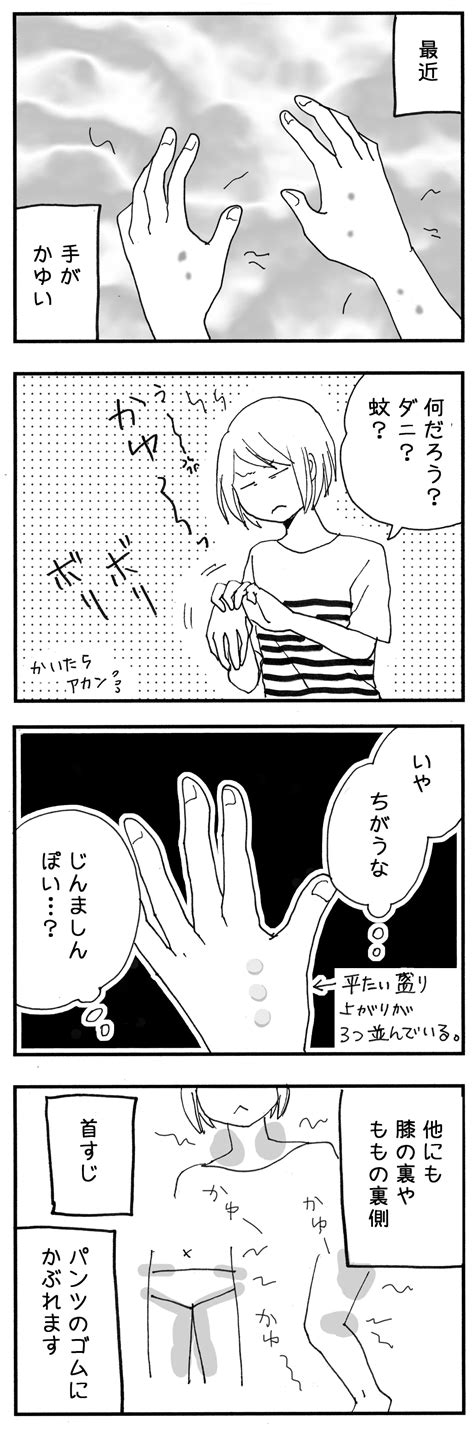かゆい! | ナイフみたいにとがってら〜反抗期男子観察日記