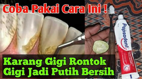 Cara menghilangkan karang gigi selanjutnya juga dapat dilakukan dengan berkumur menggunakan mouthwash. Cara Menghilangkan Karang Gigi Dengan Cepat ~ Ramuan Desa ...