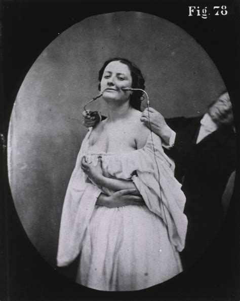 Until 1980, however, hysteria was a formally studied psychological disorder that could be found in the american psychiatric association's diagnostic and statistical manual of mental disorders. File:Duchenne Mecanisme de la physionomie humaine, fig. 78 ...
