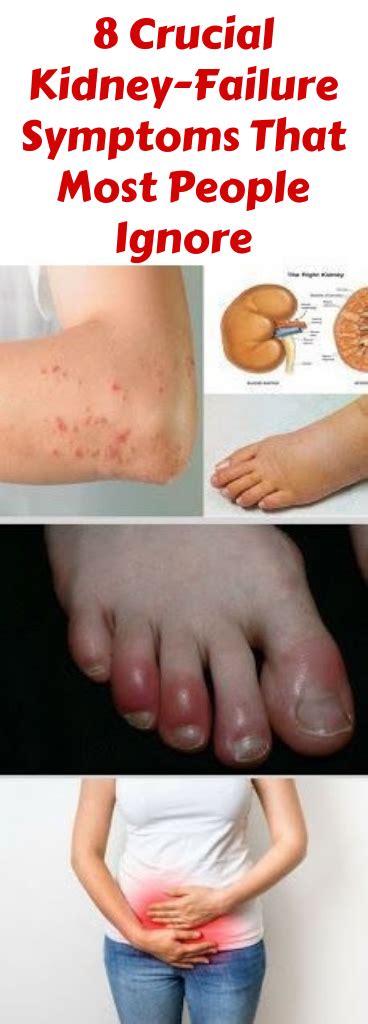 They can range in size from a small pea to as large as a grapefruit. Pin on Kidney pain