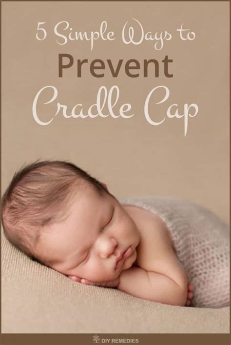 Cradle cap and seborrheic dermatitis in infants usually clears up on its own in weeks or months. 5 Simple Ways to Prevent Cradle Cap