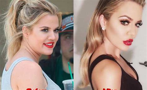 Khloe Kardashian Before : Khloé Kardashian, Before and After 