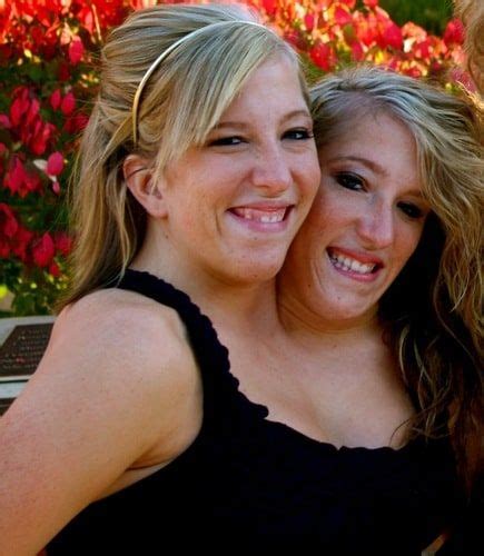 They are dicephalic parapagus twins, and are highly symmetric for conjoined twins, giving the appearance of having a single body without marked variation from typical proportions. 9 Facts About Abby And Brittany That Show There's More To Them Than Their Appearance