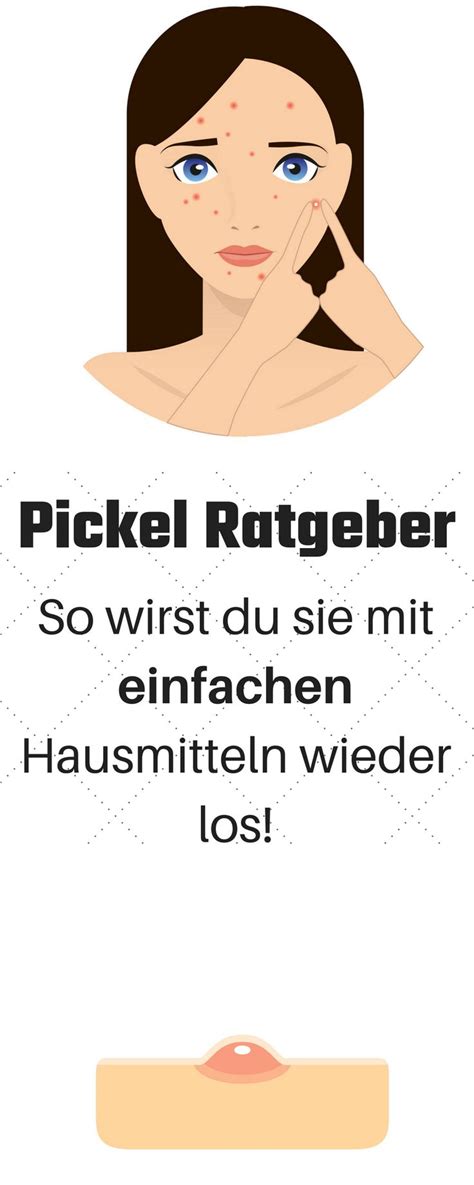 Das komedo kann als whitehead erscheinen, wenn es durch die hautschichten steigt, oder es kann verschwinden. Pickel loswerden, Pickel Hausmittel, Pickel Soforthilfe ...