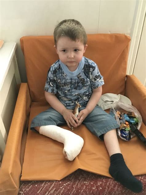 Meanings of clubfoot in german english dictionary : Aleksandr has congenital clubfoot | LAdS