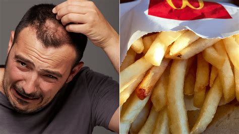 1/2 cup olive oil 3 drops tea tree oil 4 drops of rosemary essential oil 3 drops of lavender essential oil. Chemical in McDonald's Fries May Combat Baldness ...