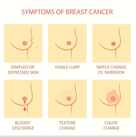 Substantial advances have been by the reduction in breast cancer incidence after an early. Know your Breast Cancer risk and early detection ...
