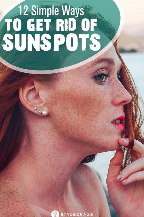 This will prevent dark spots from getting darker 12 Simple Ways To Get Rid Of Sunspots | Brown spots on ...