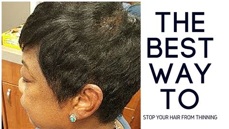 If your hair is thinning, do not fret. The Best Way To Stop Your Hair From Thinning | LaToya Jones