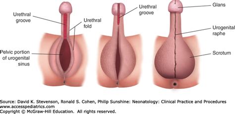 How to use intersex in a definition of intersex (entry 2 of 2). Category:Intersex medical images - Wikimedia Commons