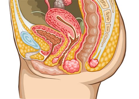 If left untreated, the tumor can spread to other parts of the body. Did you know that womb cancer is the fourth most common ...