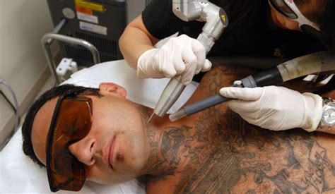 Check spelling or type a new query. gudu ngiseng blog: wrecking balm tattoo removal