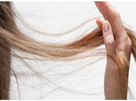Obat Penumbuh Rambut, Cara Praktis Mengatasi Rambut Rontok ...