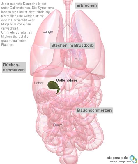 We did not find results for: Gallensteine machen oft unklare Symptome wie Brustschmerzen