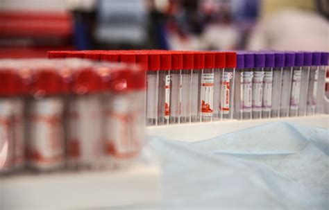 Having a low platelet count while concerning is not necessarily xxxxxxx for example, in my practice i do not worry about patients having bleeding concerns until platelets are in the 5000 to 7000 range. Blood platelets may complicate coronavirus-related disease