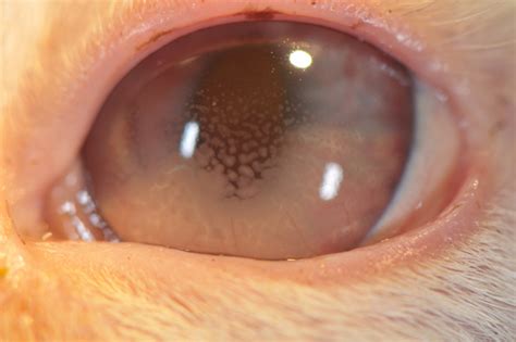 Uveitis is a serious condition that requires fast medical attention. Uveitis