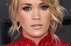 carrie face stitches underwood fall after