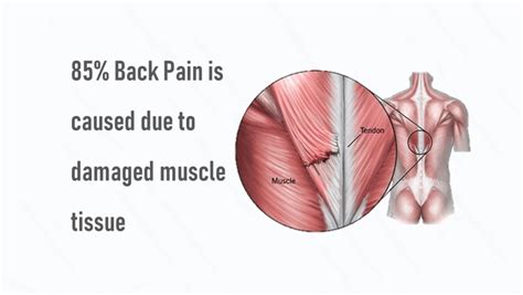 While musculoskeletal issues can be likely culprits for discomfort between the shoulder blades, sometimes the causes aren't related to a local injury at all. Upper back pain