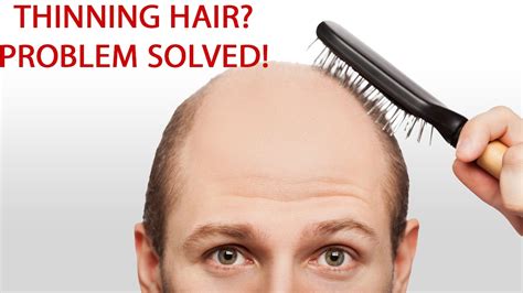 My hair does not seem to look like it is thinning.as i have a very thick head of hair. How To Prevent Hair Thinning | Thinning Hair Treatment ...