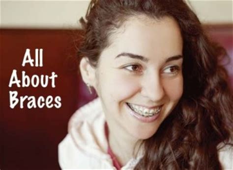 How much are the braces?: Teens Get Braces For Community Service | Orthodontics in ...