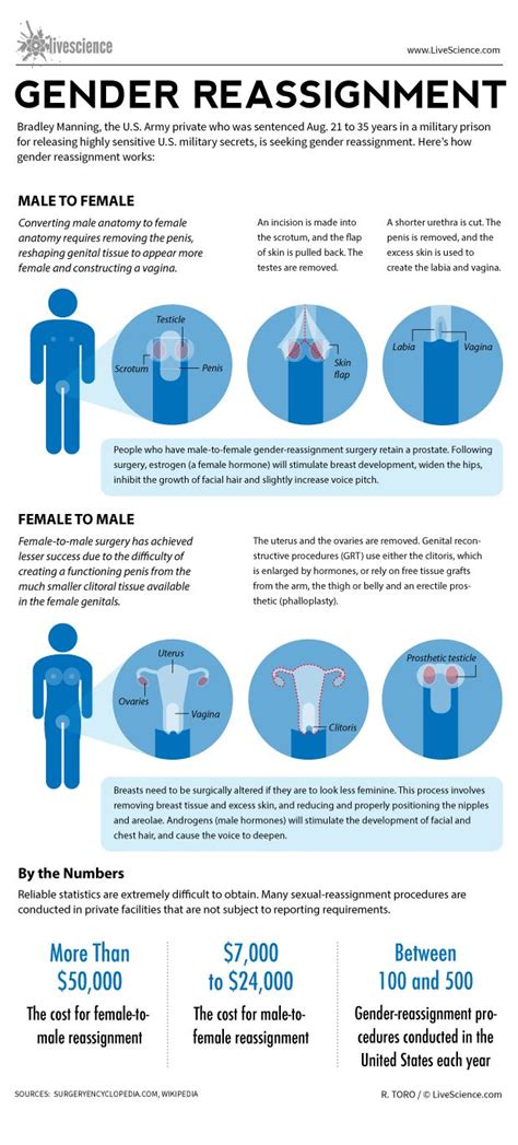 Check spelling or type a new query. How Gender Reassignment Surgery Works (Infographic) | Live ...
