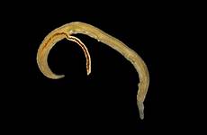 flukes mating schistosome micrograph