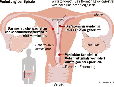 Der zeitraum, bis wann spätestens die „pille danach eingenommen werden sollte, ist bereits bekannt. Neue Hormonspirale: Konkurrenz für die Pille? | Berliner ...