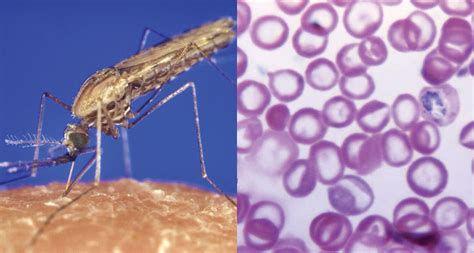 Visit the bupa health directory today and discover some information about malaria symptoms, treatment and prevention. Malaria parasites lure mosquitoes to infected hosts ...