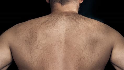 The back shaver will help you remove hair from your back smoothly. Thinking About Back Hair Removal? These Are Your Best Options.