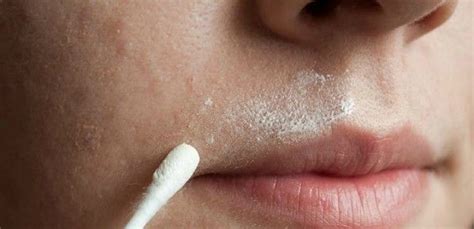 You just have to prepare a home made sugar wax and use it. Natural Home Remedy: How to Remove Unwanted Facial Hair ...