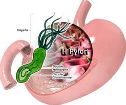 Gangguan pencernaan gastritis terjadi pada organ. Menyembuhkan Penyakit Maag Kronis Tanpa Efek Samping