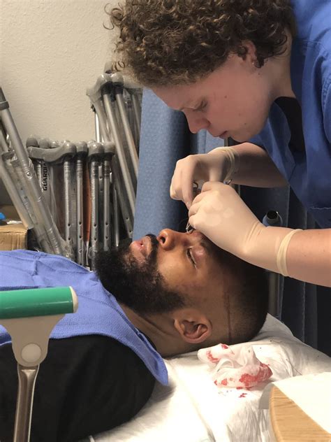 Jack suffered a horrible cut on his forehead in round 7, and he had to fight with his vision obscured in the last five rounds of the contest. Suturan herida sufrida por Badou Jack tras duelo contra ...