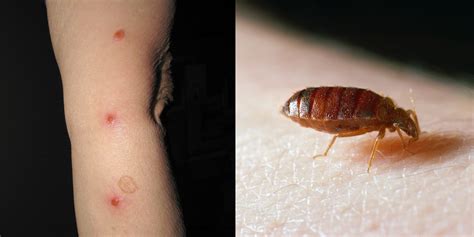 Here, bed bug bites pictures to help you figure it out, plus tips from entomologists on how to spot the symptoms. You Can Have Bed Bugs And Not Know It—Here's What To Look ...