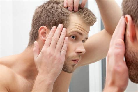 The severity of hair loss can vary from a small area to the entire body. Alopecia, Hair loss - Symptoms, causes and treatment ...