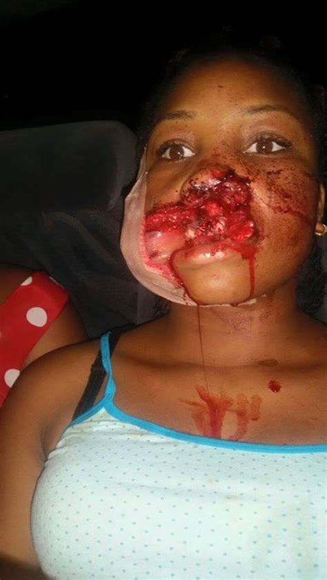 4k and hd video ready for any nle immediately. Girl Shot In The Mouth In Aluu, Rivers State. Graphic ...