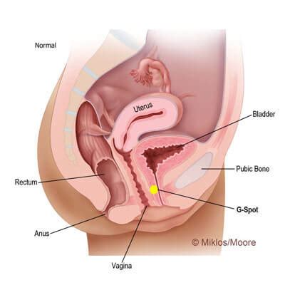 Penting lho untuk mengetahui g spot wanita. G-shot-After - Miklos, John (miklosandmoore.com)