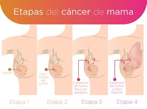 Cada vegada hi ha més regions de catalunya que han entrat en la fase 3. Implicarea genomului papiloma virusului uman (hpv) în ...