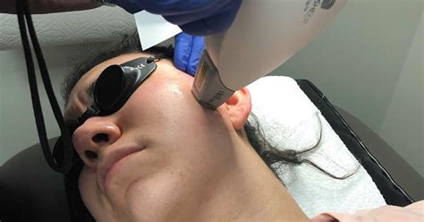 Today's electrolysis procedures are quicker and more adaptable to different types of hair. Top Notch Material: Laser Hair Removal Session 2 ...