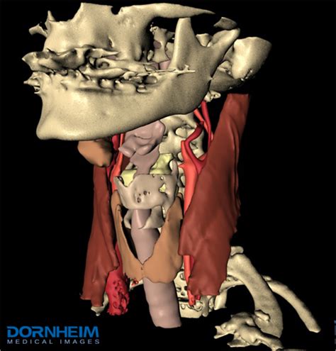 Guide to mastering the study of anatomy. A 3D model of the neck anatomy with bones, muscles, blood ...