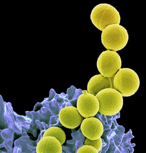 Bakterien, staphylokokken, wundversorgung, aureus und staphylococcus. MRSA in Wunden - das Wichtige zum multiresistenten Keim ...