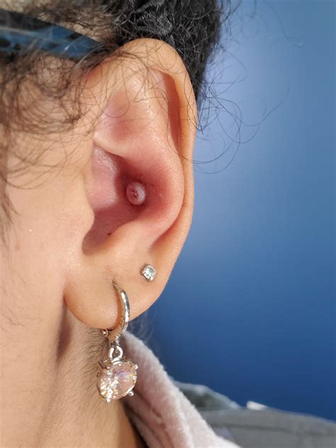 I got this conch(?) Piercing in August 2019. It was done with a needle ...