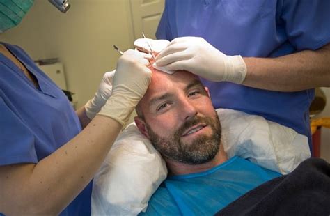 There are many factors that impact the growth and. What makes Hair Transplantation Natural?