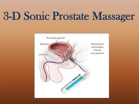 • in order to avoid the internal self prostate massage, you can opt. PPT - Self Prostate Massage PowerPoint Presentation - ID ...