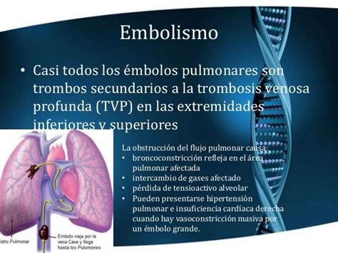 La embolia pulmonar o tromboembolismo pulmonar (tep) síntomas. Embolia pulmonar: qué es, síntomas, causas, tratamientos y ...