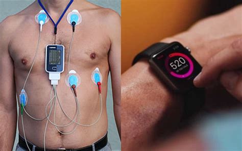 The watch app shows track stats and gps position on the map. Apple Watch ECG Trial App Unveiled | Watchaware