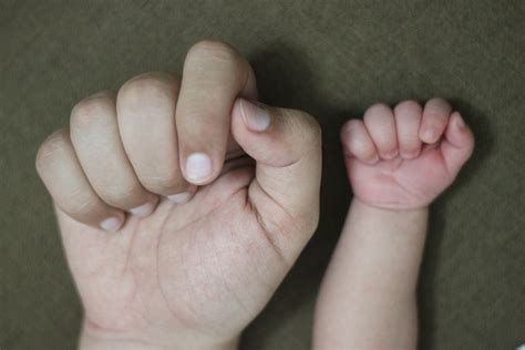 Macchie rosse sulla pelle: le cause in adulti e bambini ...